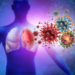viral infection