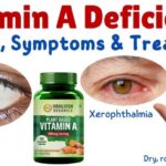 vitamin a deficiency