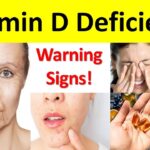 vitamin d deficiency