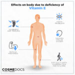 vitamin e deficiency
