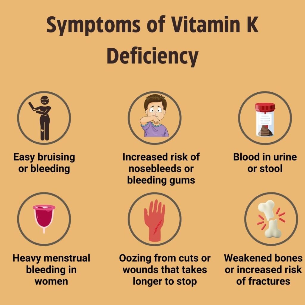 vitamin k deficiency due to fat malabsorption