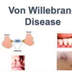 von willebrand's disease