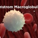 waldenstrom's macroglobulinemia