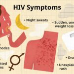 weight loss due to hiv
