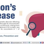 wilson's disease