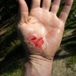 wound