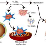 x-linked adrenoleukodystrophy