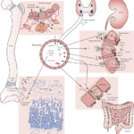 x-linked hypophosphatemic osteomalacia