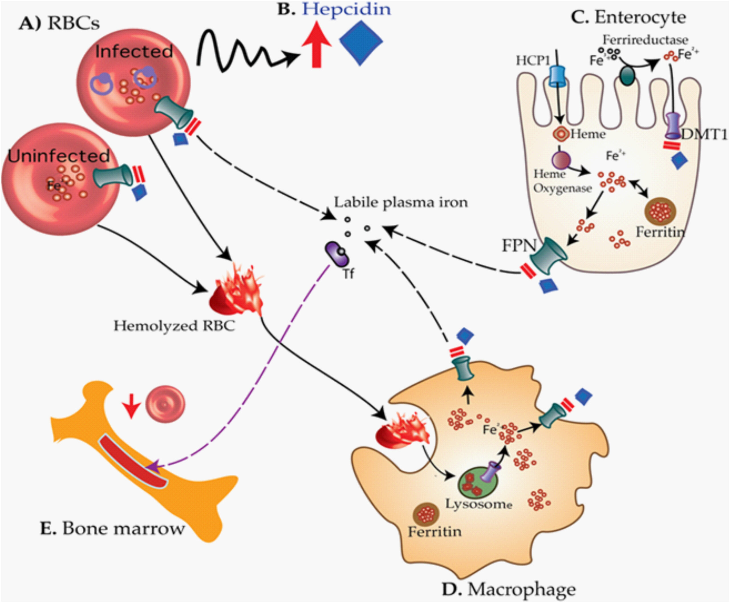 zidovudine-induced anemia