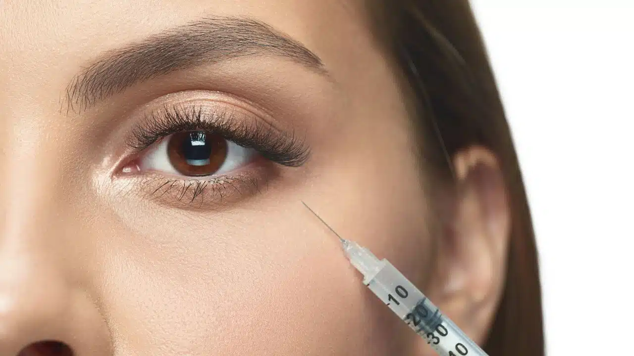 PRP for Under Eye